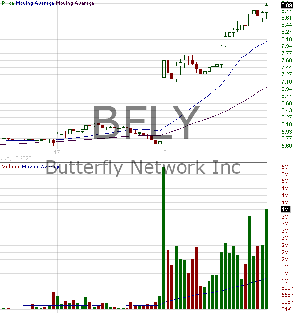 BFLY - Butterfly Network Inc. Class A 15 minute intraday candlestick chart ~15 minute delay